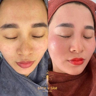Bách Y Sâm 03 Plus 30ML Duyên Thị - Mẫu Mới