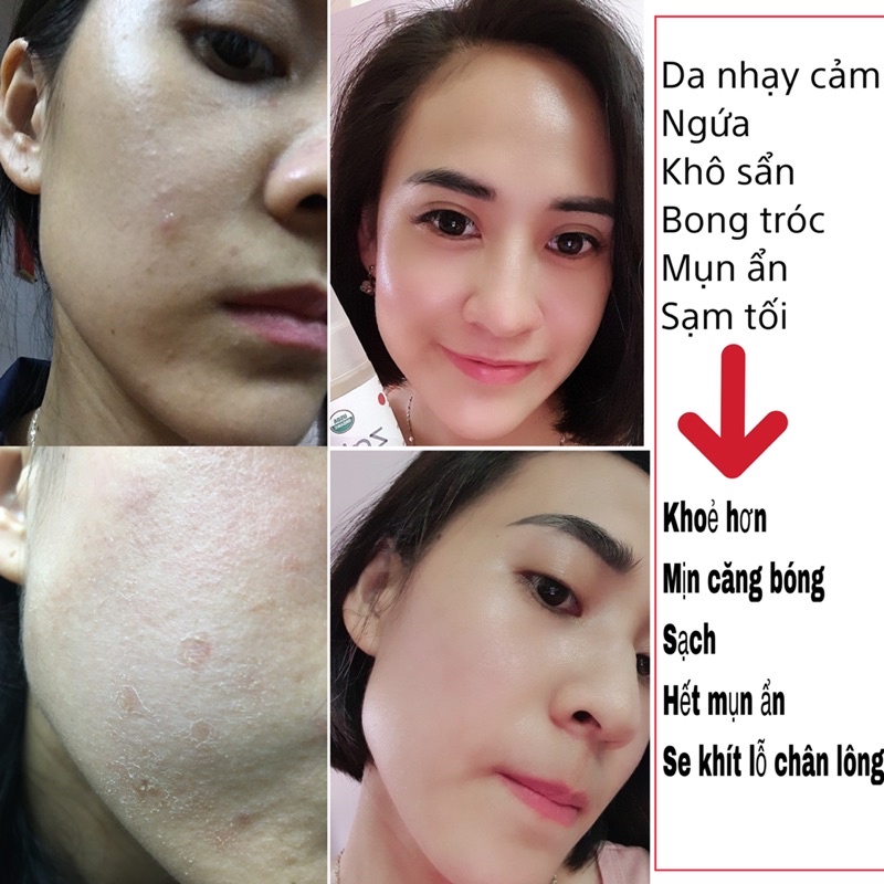 Serum Retinol 0.5% - 1% Skinsolve trẻ hoá da