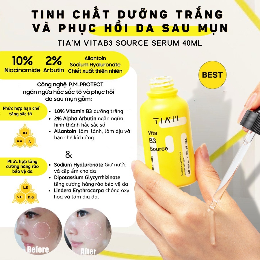 Tinh Chất Dưỡng Trắng Da, Phục Hồi Da Sau Mụn, Kiểm Soát Dầu Nhờn, Ngăn Lão Hóa Tiam Serum 40ml