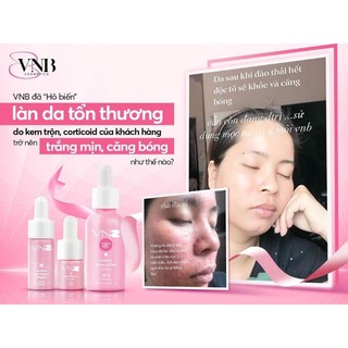 Tinh chất trẻ hóa vnb date mới( date 2027)