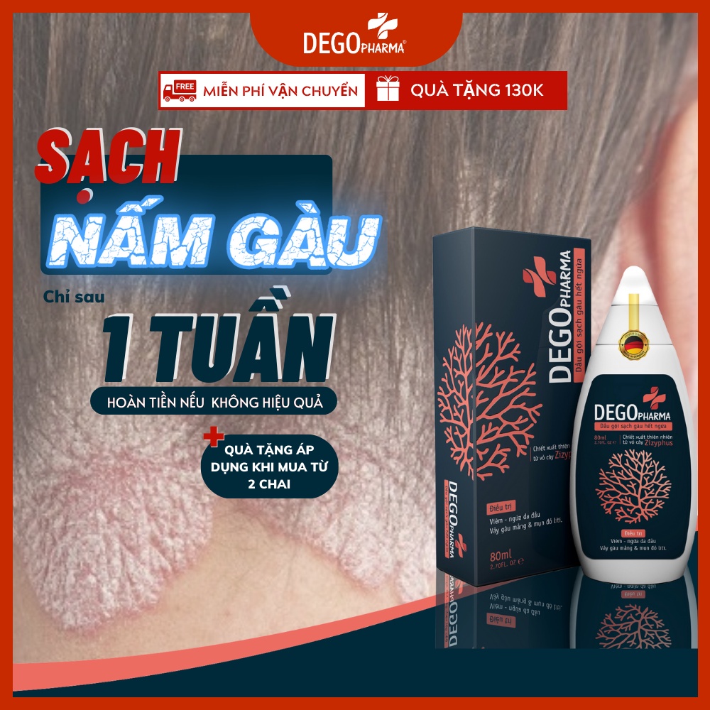 Dầu gội đầu sạch gàu, nấm da đầu, phục hồi nang tóc và chống rụng tóc, dầu gội thảo dược an toàn DEGO PHARMA