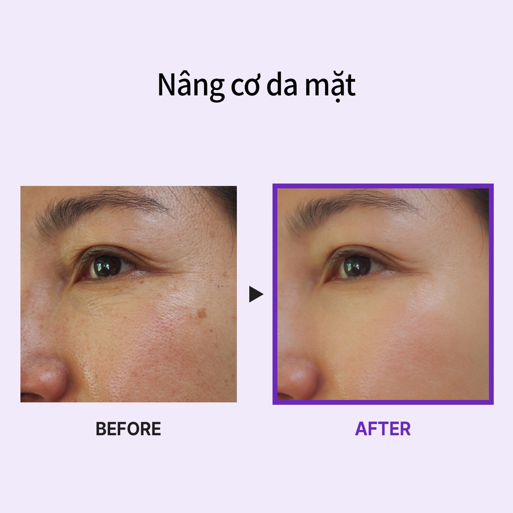 Medi-Peel Tinh chất chăm sóc da MEDIPEEL Peptide 9 Volume tất cả trong một 100ml