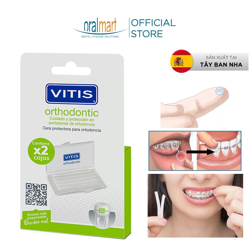 Sáp nha khoa giảm đau khi niềng răng - Vitis Orthodontic Wax (Vỉ 2 hộp)