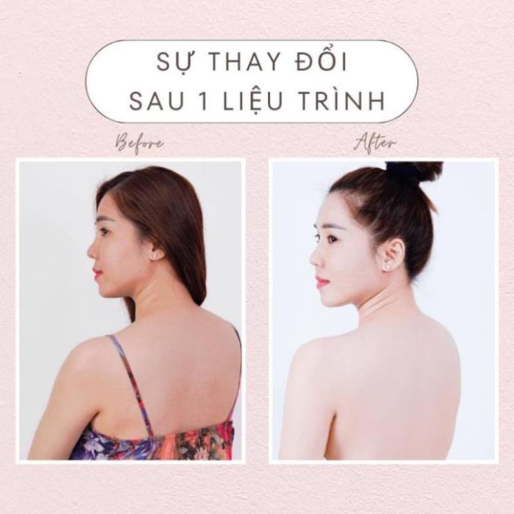 Viên Uống Trắng Da GLUTATHIONE 16000 - Viên Uống COLLAGE  Trắng Da Mờ Nám Giảm Nếp Nhăn