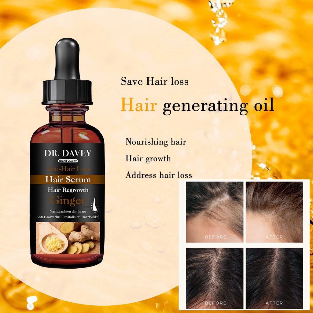 Thiên nhiên gừng  Tinh dầu mọc tóc/dưỡng tóc  kích thích mọc tóc Xịt mọc tóc hair growth serum 50ml