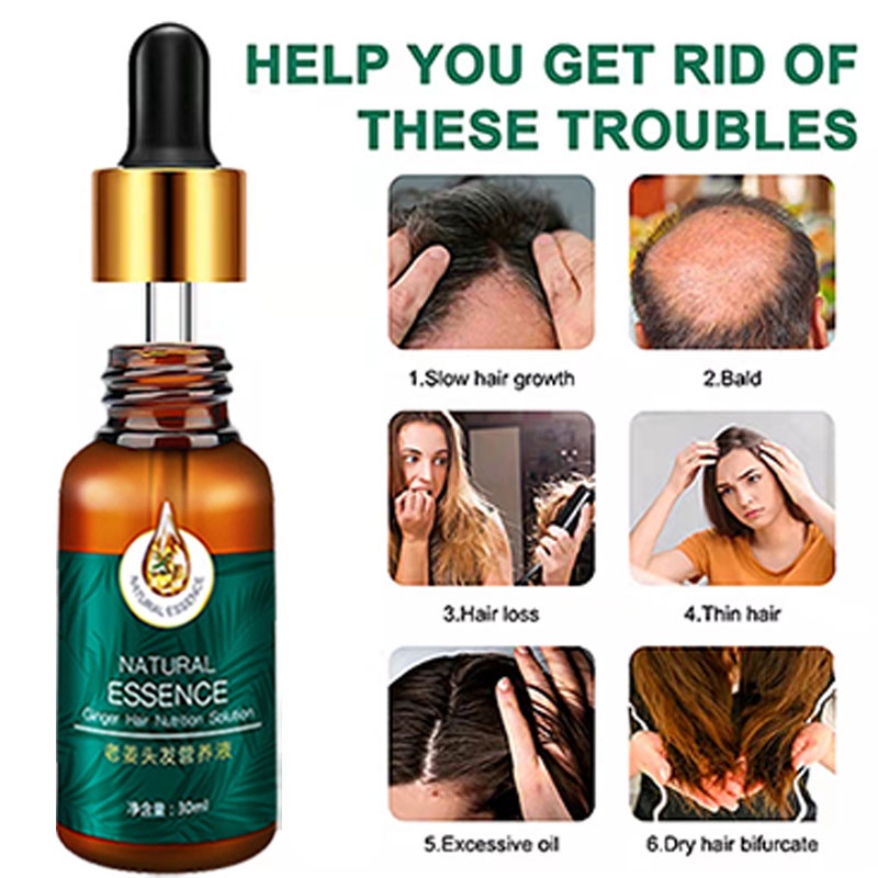 Tinh Dầu Gừng Kích Thích Mọc Tóc Tự Nhiên 30ml