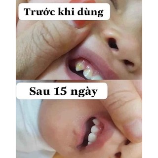 boi sau rang