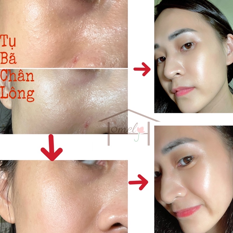 Serum detox Trẻ Hoá Da từ Mandelic acid Skinsolve Pore Detoxifying