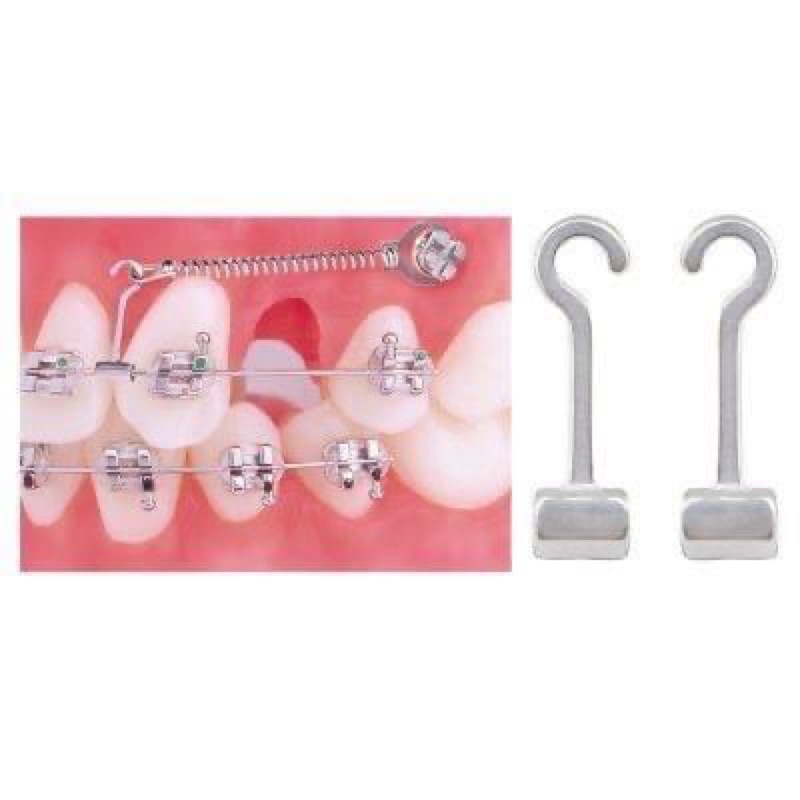 HOOK CHỈNH NHA (hook trái, hook phải, hook thẳng, hook 3 móc)