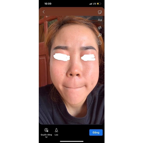 Serum Giảm Mụn Thâm Rỗ Sáng Da Skin Care Acne - Tác Dụng 5 in 1 hiệu quả qua 5 ngày trải nghiệm