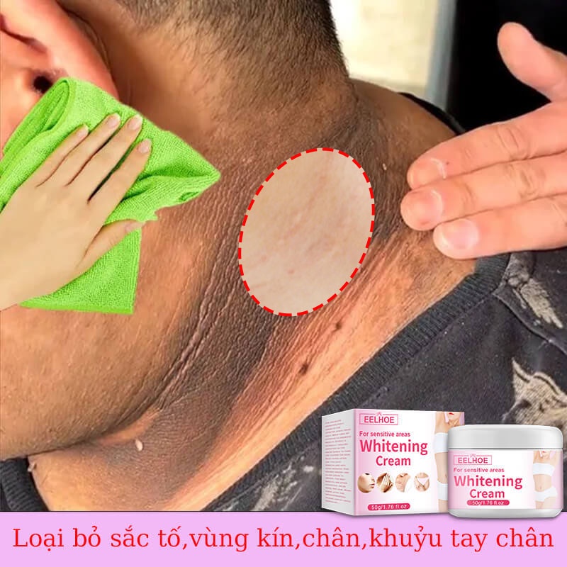 Kem làm trắng da vùng dưới cánh tay làm trắng âm đạo làm sáng da đầu gối vùng da àm trắng mông cổ vùng đùi 50g
