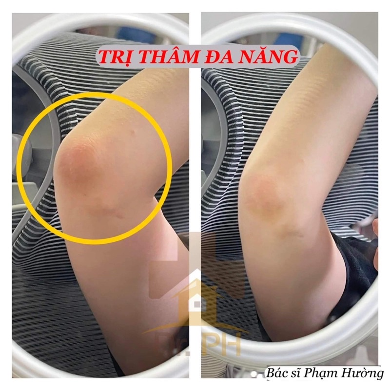 Kem Làm Hồng Nhũ Hoa Bikini 30ml Giảm Thâm Nách , Môi , Đầu Gối , Mông , Dưỡng Trắng Vùng da Thâm Xạm