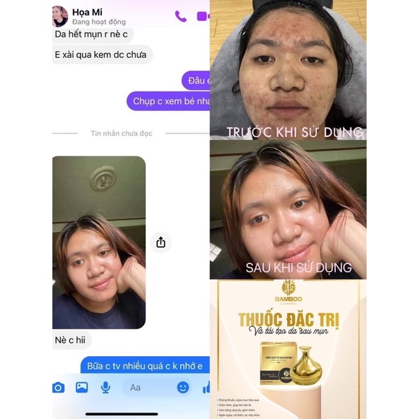 Kem Mụn Bamboo tặng sữa rửa mặt hoa gạo bamboo