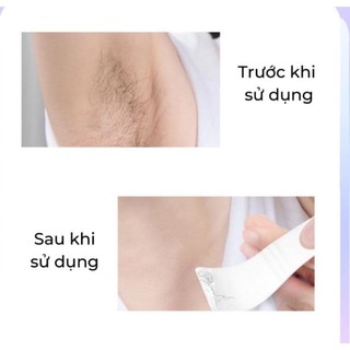 KEM TẨY LÔNG POITEAG