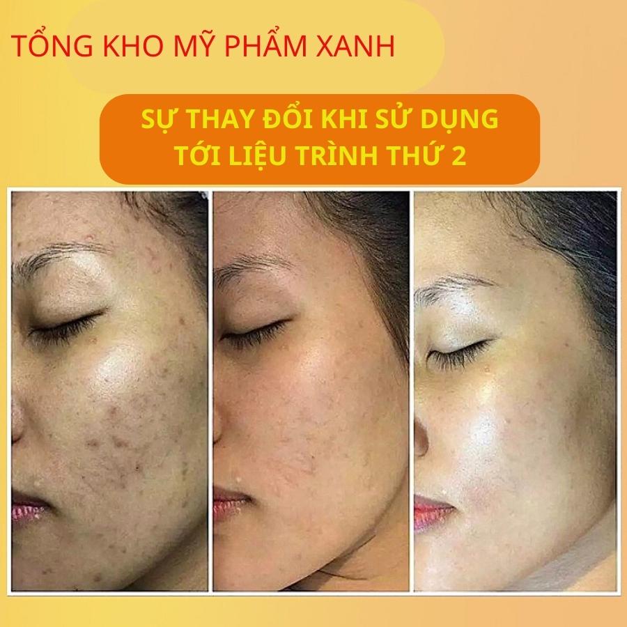 Viên Uống Trắng Da GLUTATHIONE 16000mg Trắng Da Mờ Nám Làm Chậm QUá Trình Lão Hóa Da Hộp 2 Lọ 30 viên