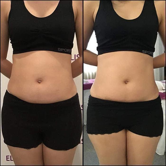 Gel tan mỡ Slimmee Perfect Fit 100g của Pháp