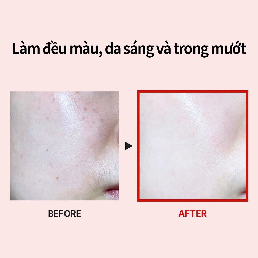 Medi-Peel Serum MEDIPEEL mờ nám tàn nhang sáng da ngăn ngừa lão hóa dưỡng da cấp ẩm làm trắng Melanon X Ampoule 30ml