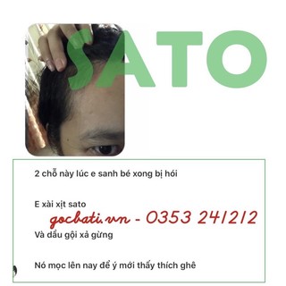 SATO KO RỤNG TÓC