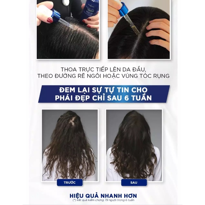 Tinh chất kích thích mọc tóc Loreal Serioxyl Denser Hair 90ml