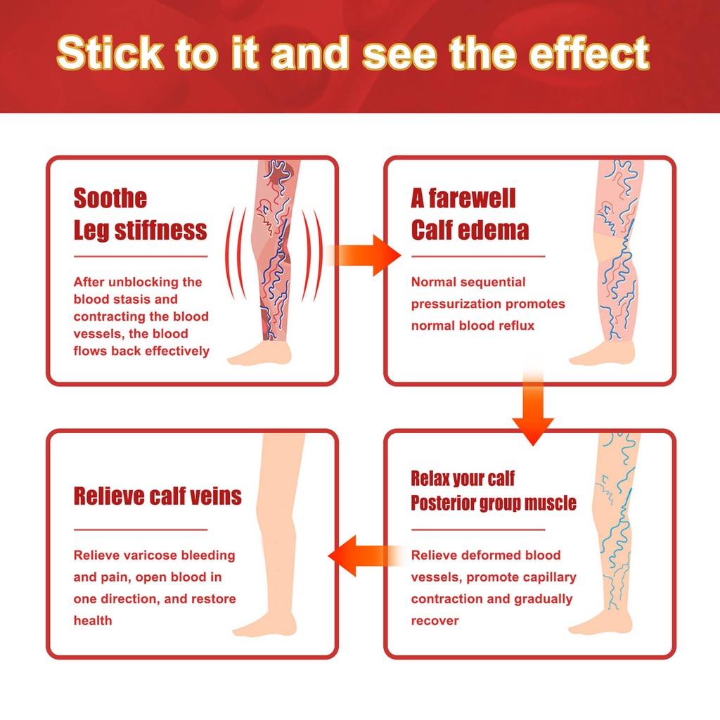 Miếng dán giảm giãn tĩnh mạch 12 miếng sửa chữa tĩnh mạch chân phồng lên bằng giun đất sưng đau chân