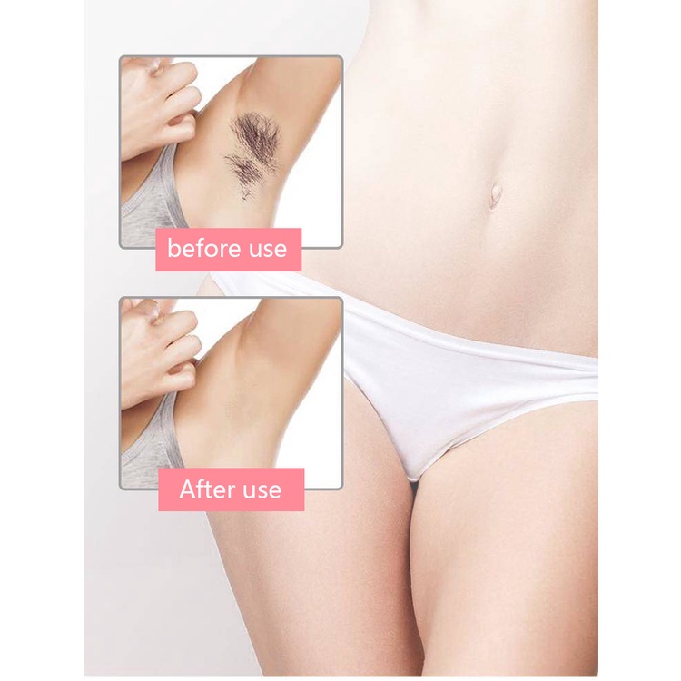 Máy Triệt Lông Kemei - Máy Tẩy Lông Mini , Triệt Lông Vĩnh Viễn