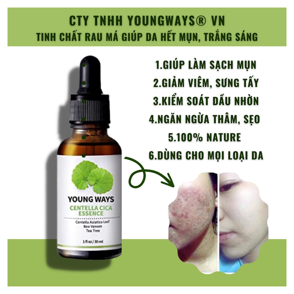 Serum ngừa mụn Youngways, Made in korea, 10ml