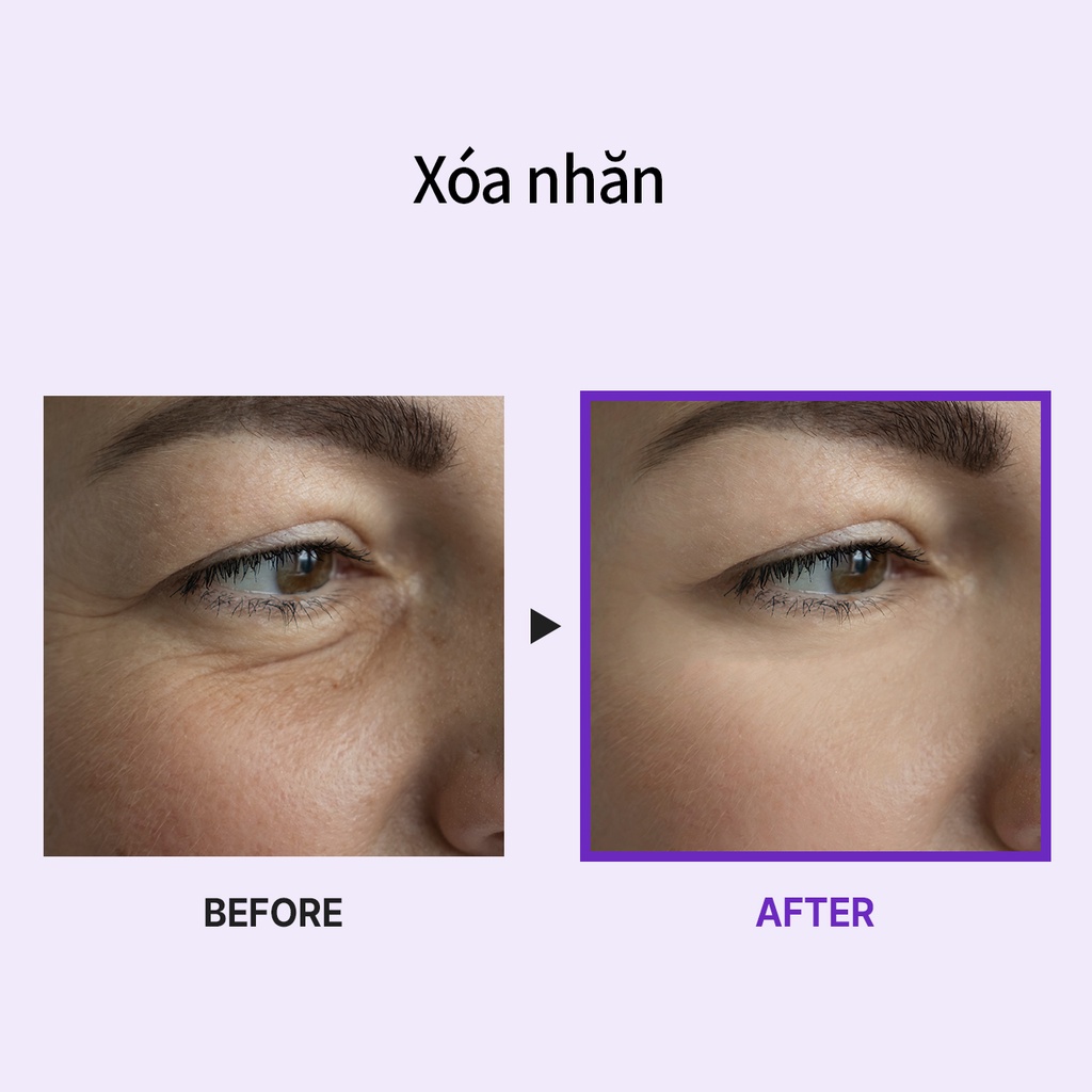 Medi-Peel Tinh chất MEDIPEEL PEPTIDE 9 VOLUME BIO TOX AMPOULE cao cấp 100ml