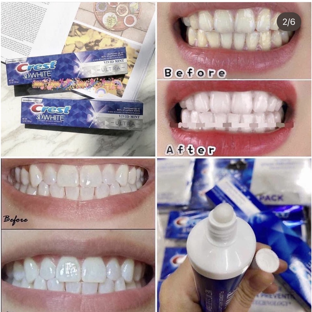 Kem Đánh Răng Crest 3D White Advanced Tripple Whitening