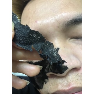 Gel lột mụn than tre Ladevan