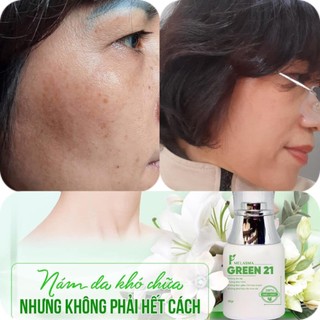 MELASMA GREEN 21 - PHAN AN GREEN