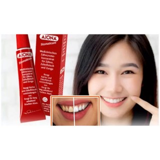 [Nội Địa Đức] Kem Đánh Răng Ajona Đức 25ml
