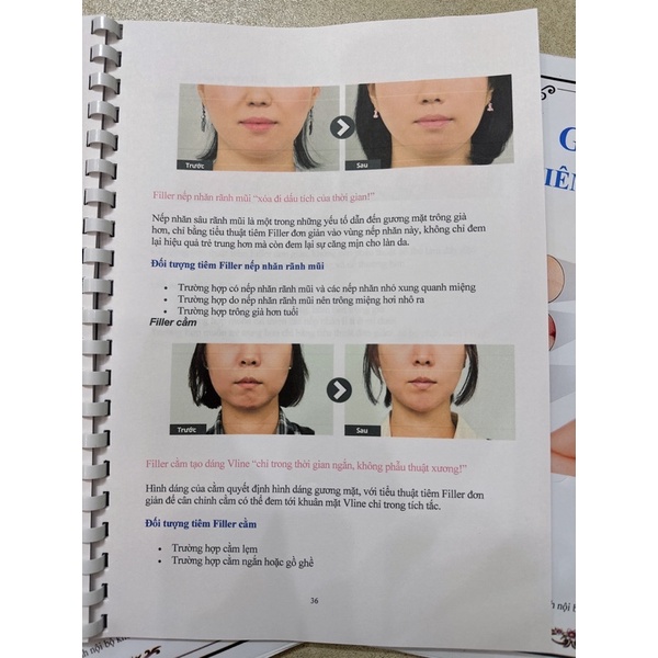 Hướng dẫn TIÊM FILLER & BOTOX đầy đủ, chuyên nghiệp cho spa