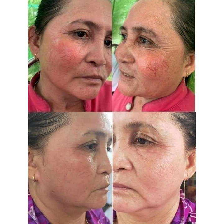 Serum Nhân Sâm Thay Da MQ Skin Chính Hãng