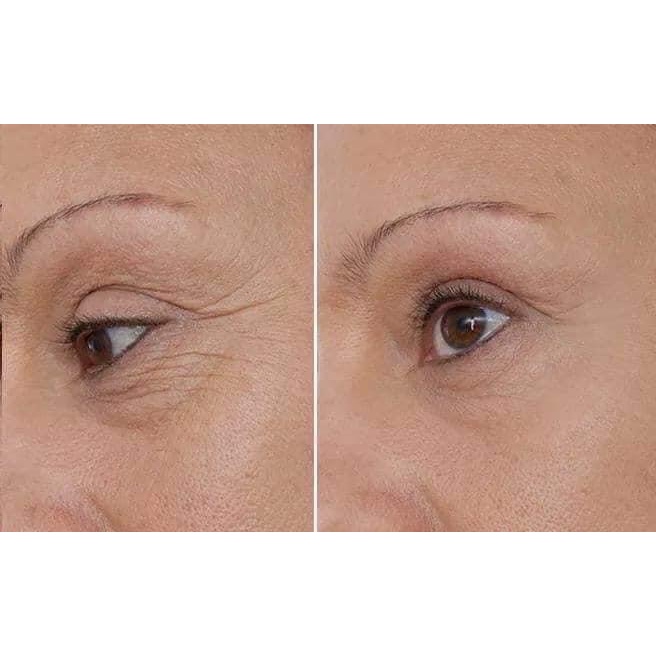 Set Kem dưỡng mắt Sulwhasoo Concentrated Ginseng Renewing Eye Cream Set