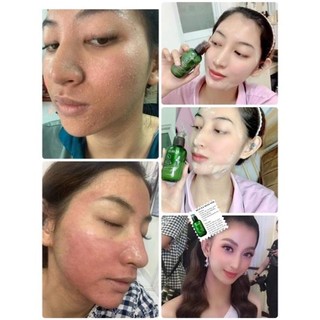 Serum Thay Da Nhân Sâm Củ Chính Hãng