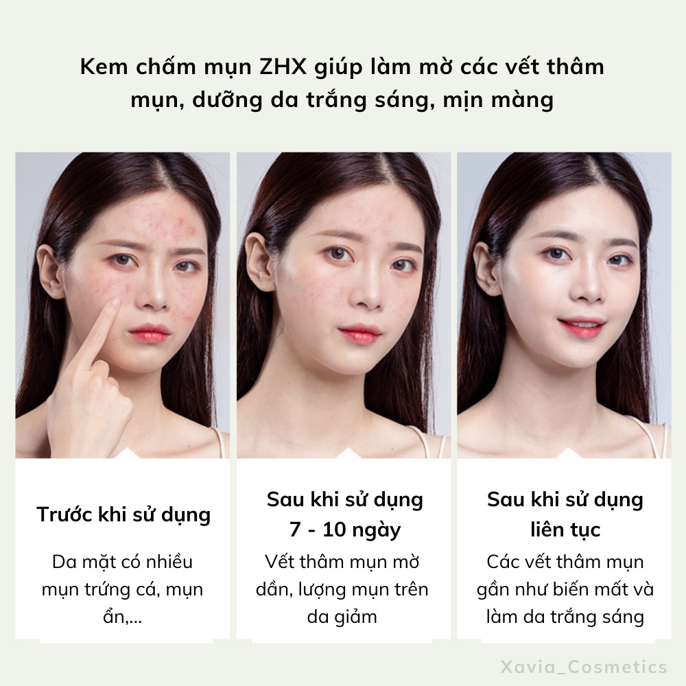 Kem chấm mụn ZHX - Kem hỗ trợ làm mờ thâm mụn, giảm mụn trứng cá, mụn ẩn, mụn bọc, mụn viêm hiệu quả