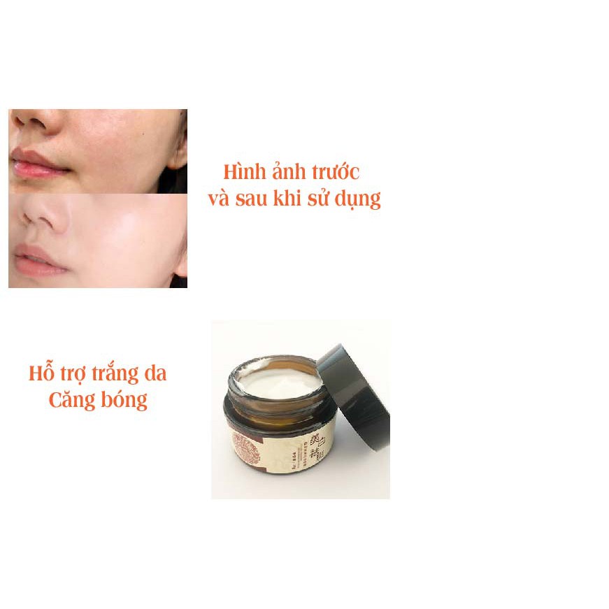 Hộp Kem bôi Nám - Tàn Nhang - Trắng da