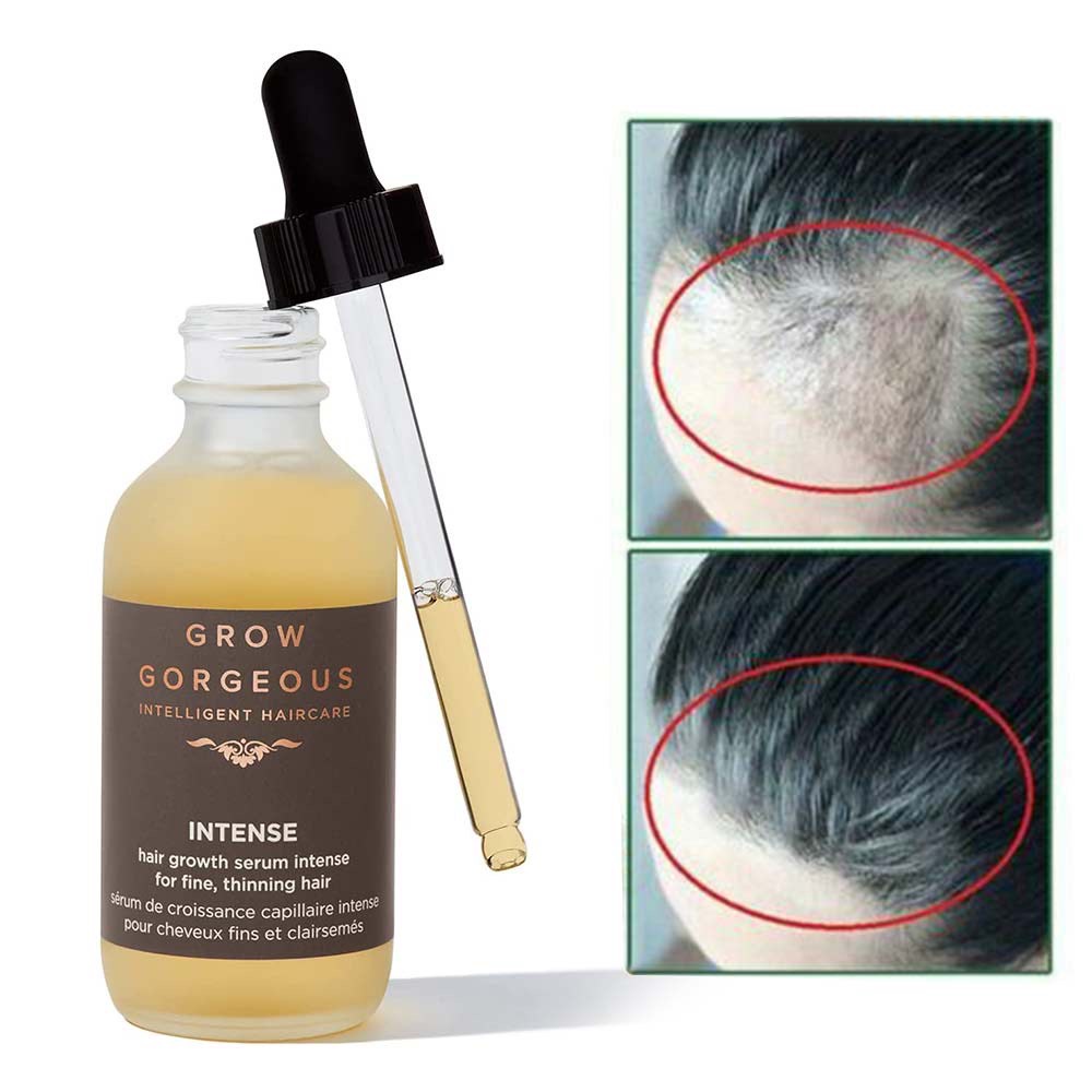 Serum Kích Mọc Tóc Grow Gorgeous Hair Density mọc tóc giảm rụng làm dầy tóc Ngăn ngừa rụng tóc, kích mọc tóc