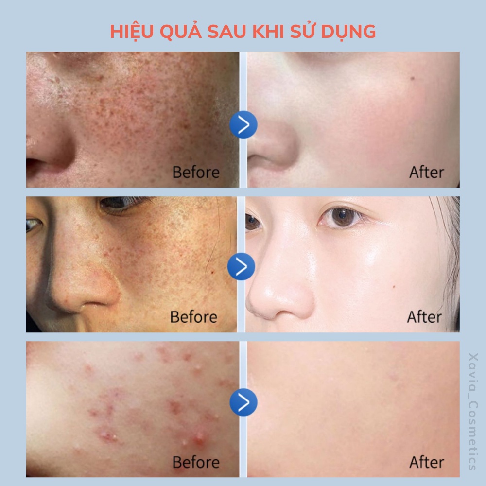 Sữa rửa mặt sữa ong chúa Facial Cleanser - Sữa rửa mặt dưỡng trắng, làm sạch da và chống lão hóa hiệu quả