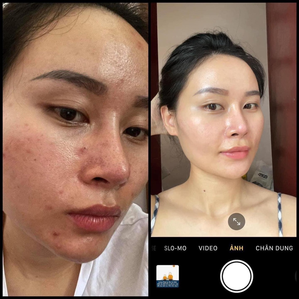 Serum La Roche-Posay B5 Hyalu Tái Tạo Và Phục Hồi Da