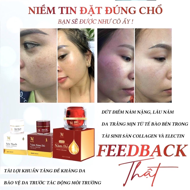 Kem Face Nám SÂM ĐỎ  Ngừa Sạm Nám, Giúp Trẻ Hoá Căng Bóng Da
