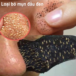 Mặt nạ mụn đầu đen, gel mụn đầu đen, mặt nạ làm sạch, làm săn chắc da, làm trắng da