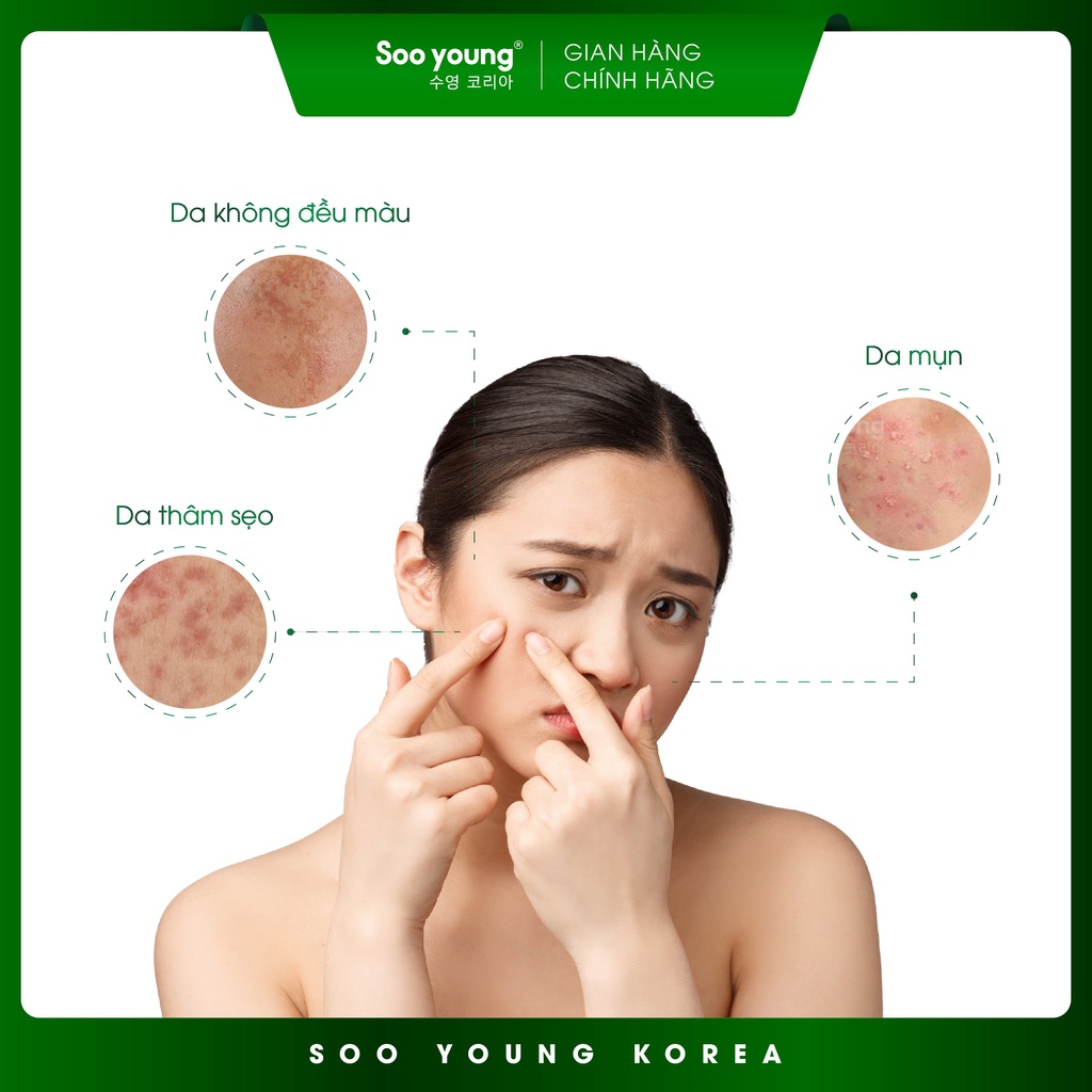 Bộ đôi kem mụn SOOYOUNG KOREA ngừa mụn giảm thâm 20gr