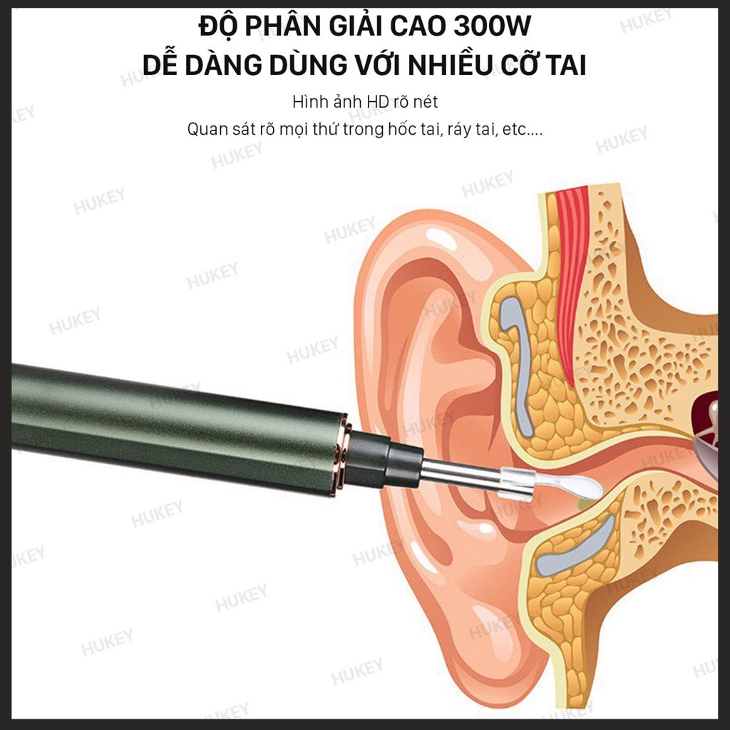 Dụng cụ lấy ráy tai, Camera Nội Soi Tai Siêu Nét Đi Kèm Bộ Đầu Lấy Ráy - Thiết kế Thông Minh, Nhỏ Gọn, An Toàn