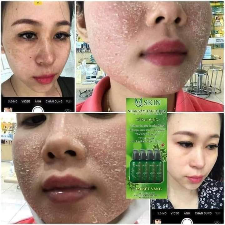 Serum Nhân Sâm Thay Da MQ Skin Chính Hãng