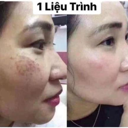 Viên Uống GLUTATHIONE 1000mg Giúp Da Mờ Nám, Hỗ Trợ Trắng Da, Chậm Quá Trình Lão Hóa Da
