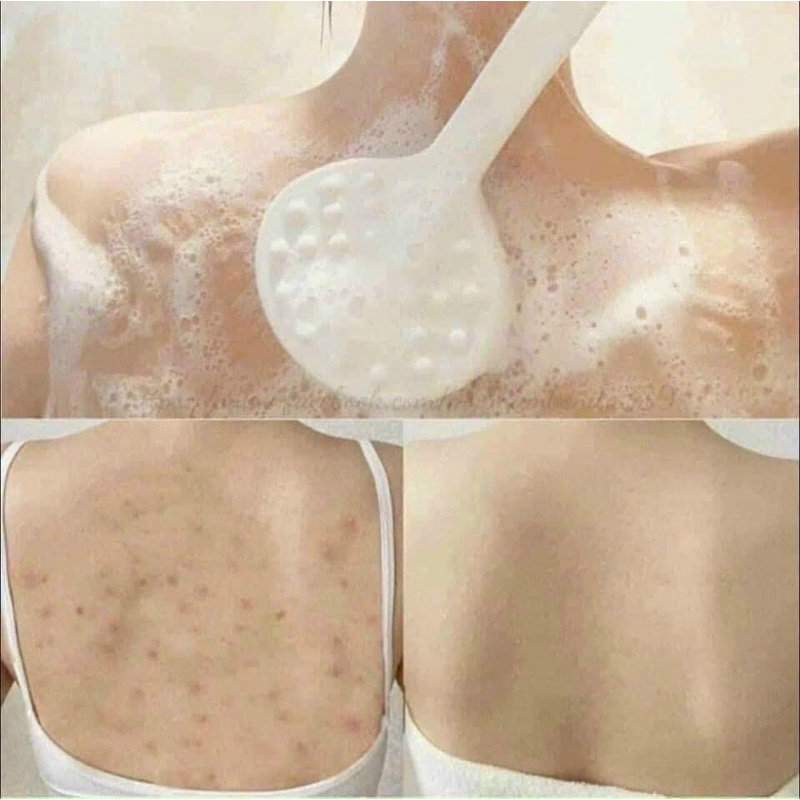 Sữa tắm than tre Thái Lan giảm mụn lưng mờ thâm