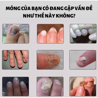 Serum nấm móng tay chân