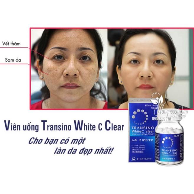 Viên uống trắng da Transino White C Clear Nhật Bản 120 viên, 240 viên | BigBuy360 - bigbuy360.vn