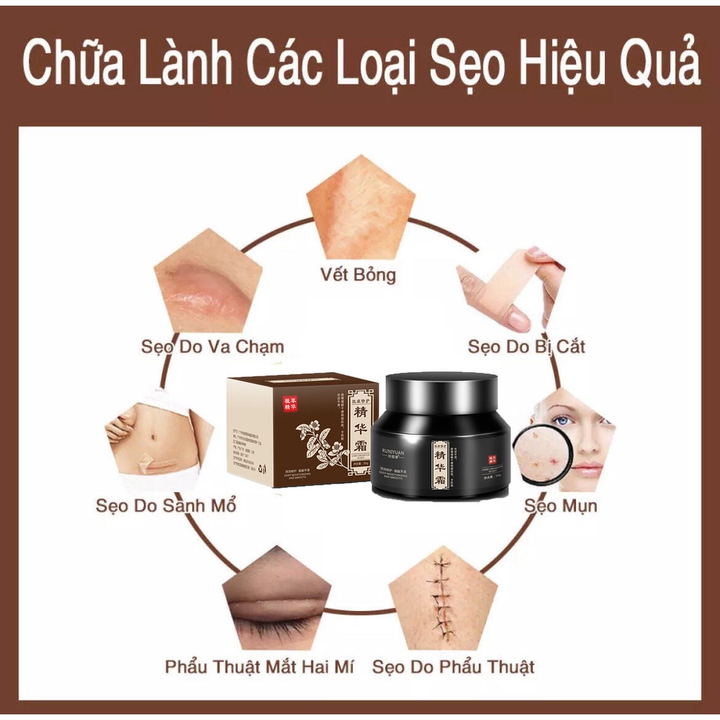 Kem Sẹo Kem xóa Sẹo Thâm Kem sẹo 50g Xóa sẹo thâm rạn da hiệu quả mờ thâm bỏng thương phẫu thuật